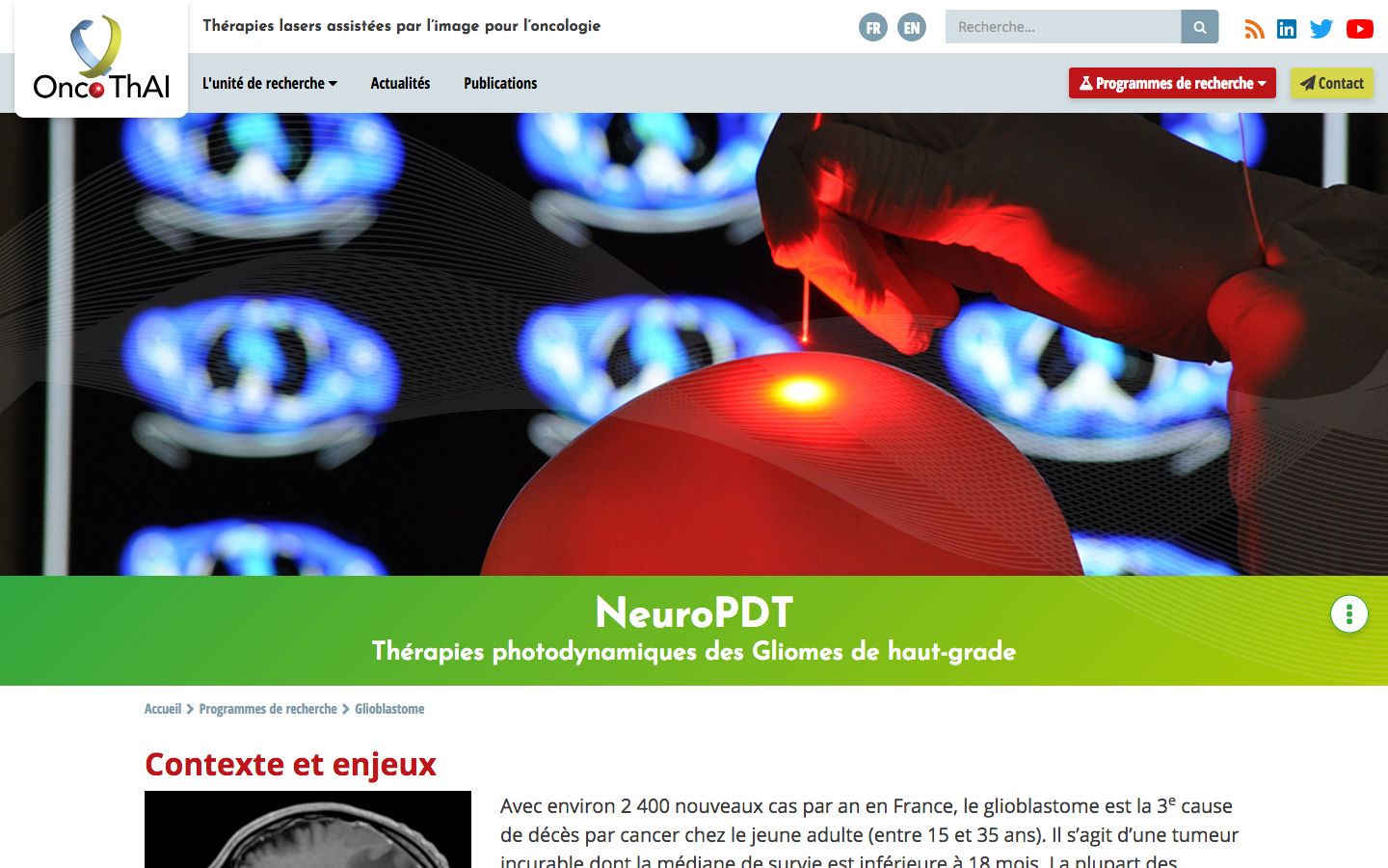 OncoThAI page glioblastome